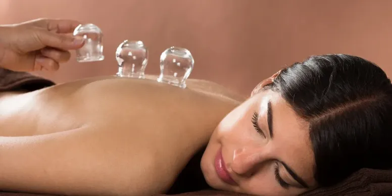A woman receiving glass cupping therapy on her back.